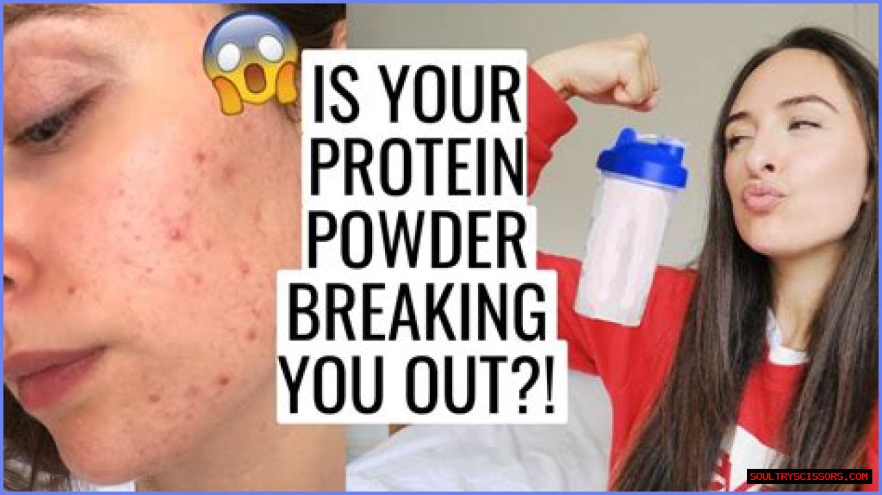 Can Soy Protein Cause Acne?