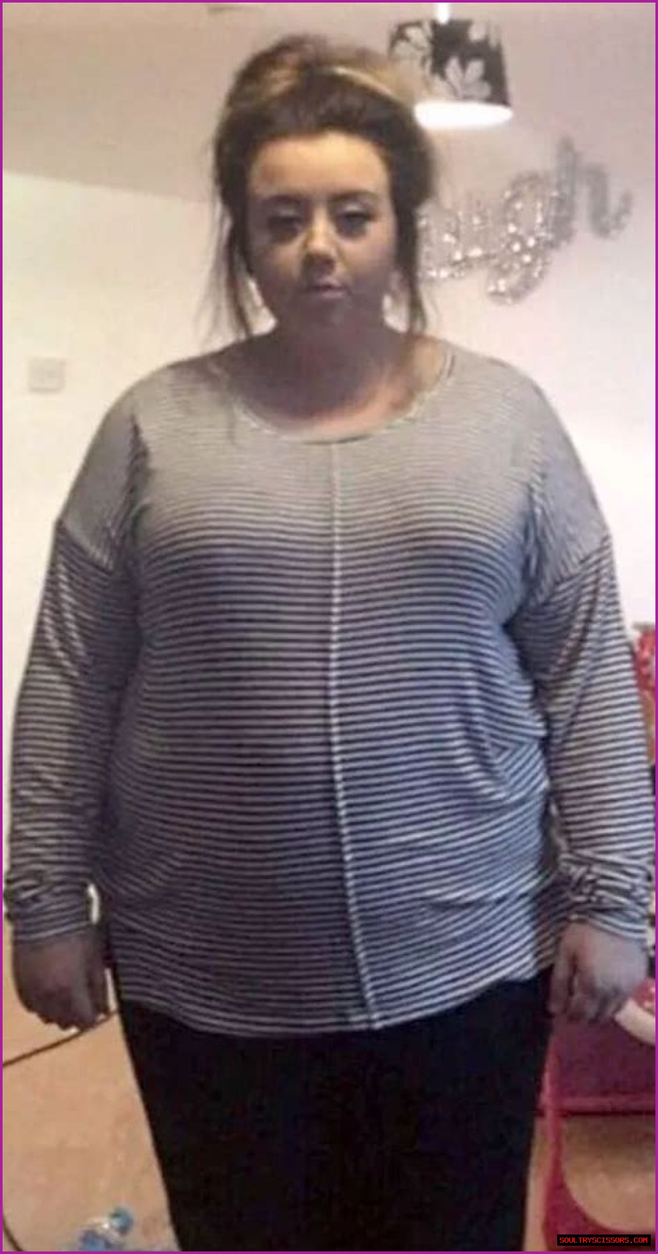 ‘So much fat!’ – the cruel autopsy of a 17-stone woman on the BBC